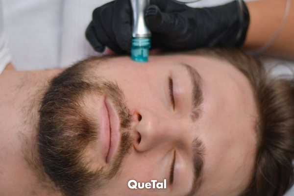 Hidrofacial : El tratamiento facial para hombre más buscado del mundo